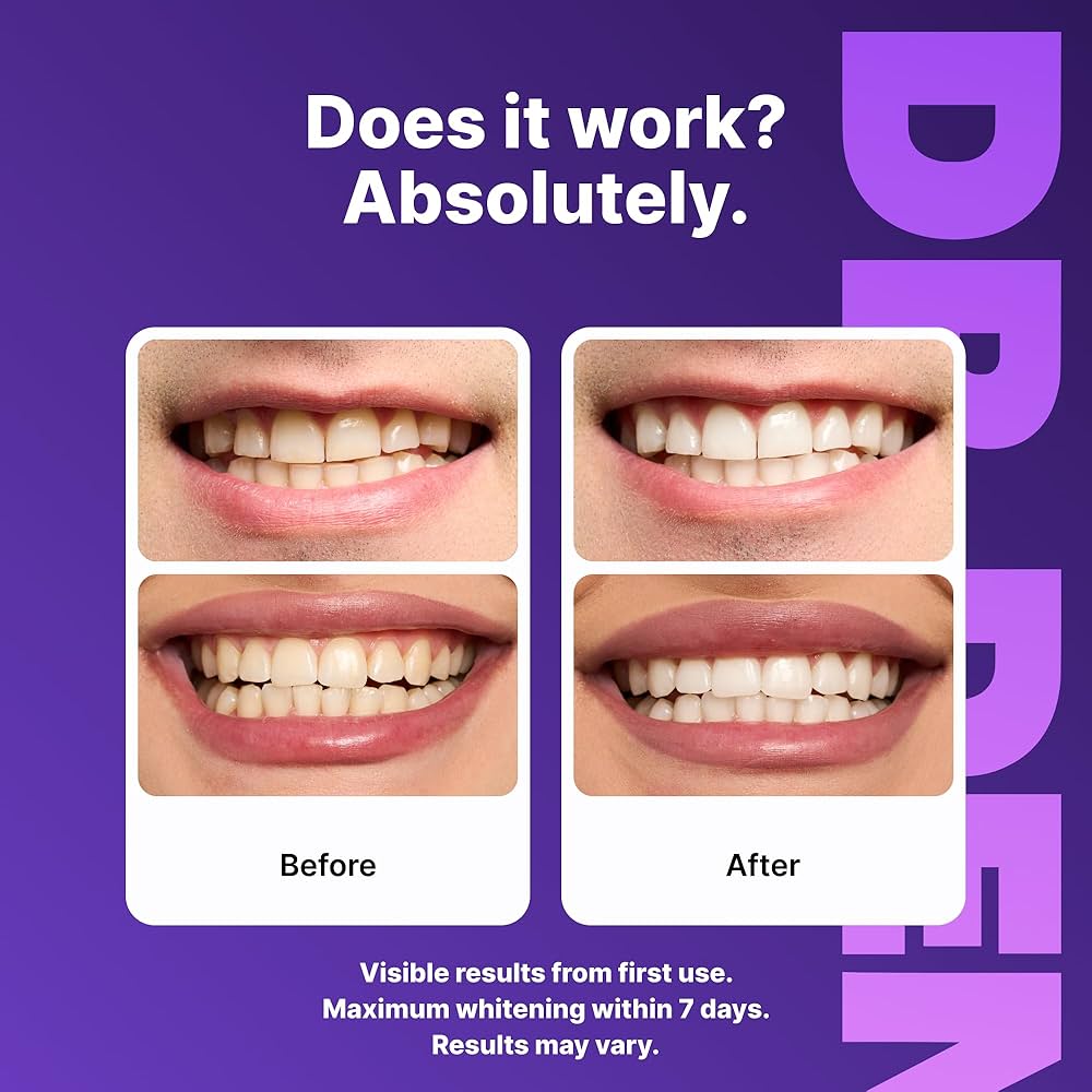 DR.DENT Purple Teeth Whitening Strips 42's Pack